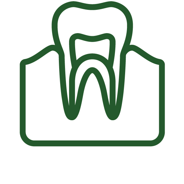 Renton Root Canal Special